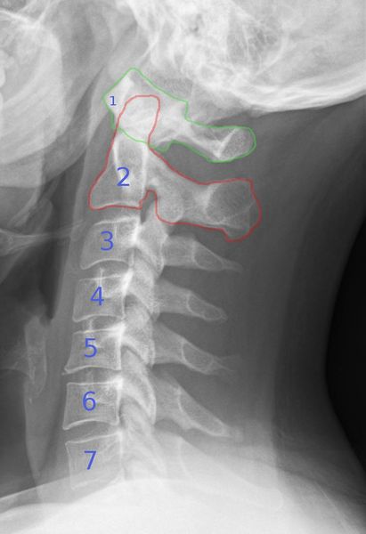 File:HWS seitlich Annotation.jpg