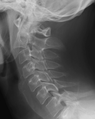 Thumbnail for version as of 03:04, 10 February 2014
