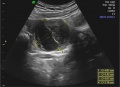 Thumbnail for version as of 22:41, 12 October 2017