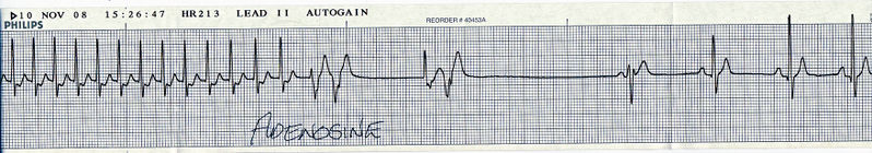 File:Hr scan.jpg