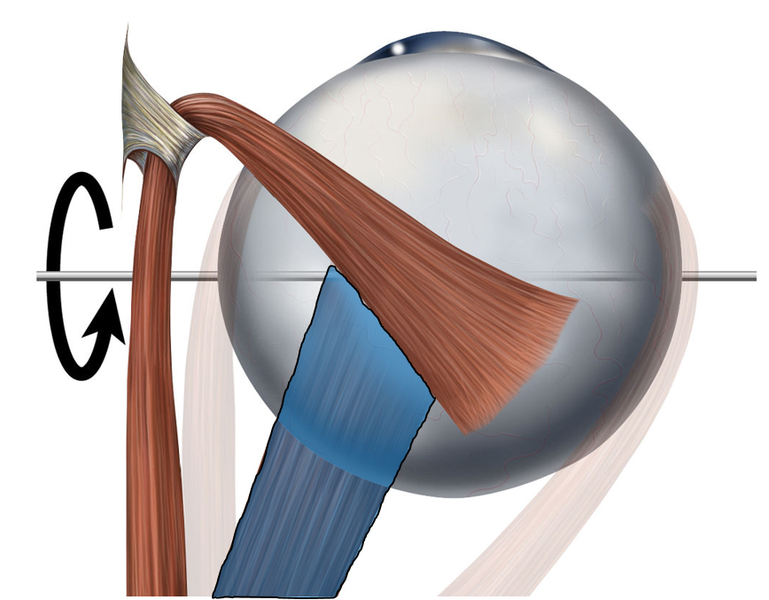 File:Infrectus.png