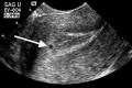 Thumbnail for version as of 03:02, 14 October 2017