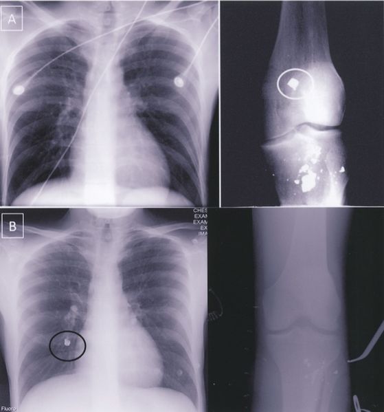 File:Leg chest.jpg