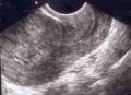 Thumbnail for version as of 20:43, 18 October 2017