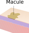 Macule.png