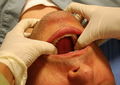 Thumbnail for version as of 23:31, 13 September 2011