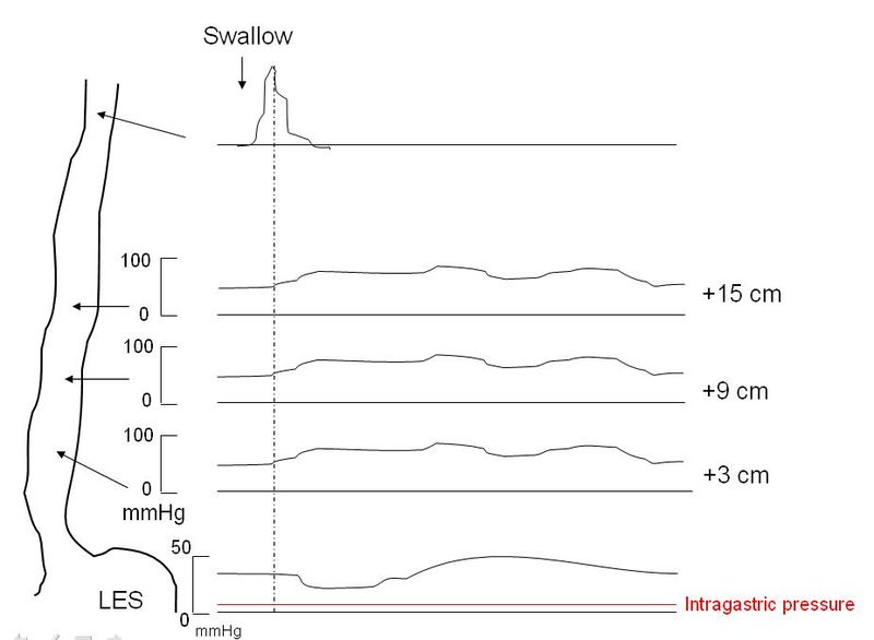 File:Manometry.jpg
