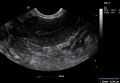 Thumbnail for version as of 22:02, 12 October 2017