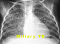 Thumbnail for version as of 16:43, 7 November 2014