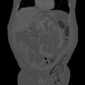 Thumbnail for version as of 07:00, 30 October 2014