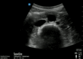Thumbnail for version as of 11:53, 11 April 2016