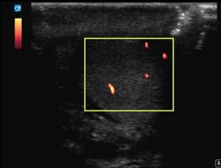 Normal testicular flow.JPG