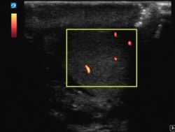 Normal testicular blood flow