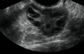 Thumbnail for version as of 20:43, 18 October 2017