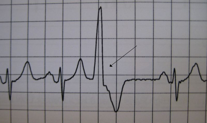 File:PVC10.jpg