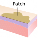Patch.png