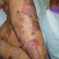 Thumbnail for version as of 05:18, 17 February 2016