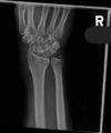 Thumbnail for version as of 17:26, 26 October 2014