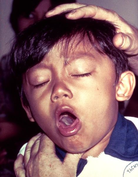 File:Pertussis.jpg