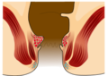 Thumbnail for version as of 11:07, 15 February 2017