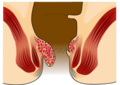 Thumbnail for version as of 11:09, 15 February 2017
