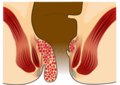 Thumbnail for version as of 11:11, 15 February 2017