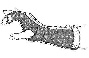 Radial Gutter3.gif