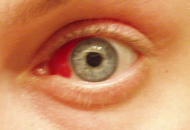 File:Redeye photograph.jpg