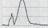 STEMI-b.jpg