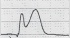 STEMI-c.jpg