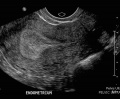 Thumbnail for version as of 21:59, 12 October 2017