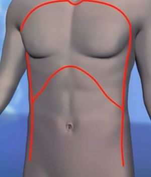 Shield incision.JPG