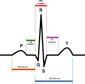 SinusRhythmLabels.svg