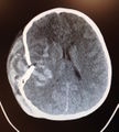 Thumbnail for version as of 02:38, 21 January 2016