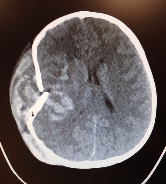 File:Skull fx.JPG
