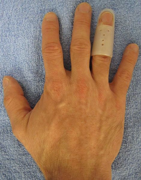 File:Splint1.jpg