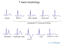 Thumbnail for version as of 04:34, 25 February 2015