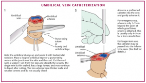 UVC-Procedure.png