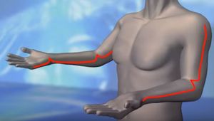 Upper extremity.JPG