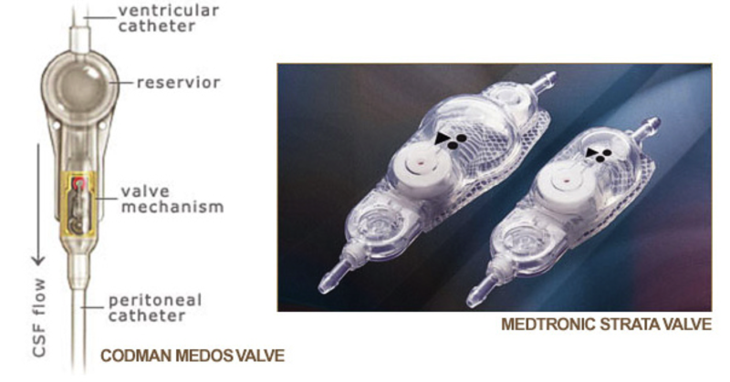 File:Vpvalve.png